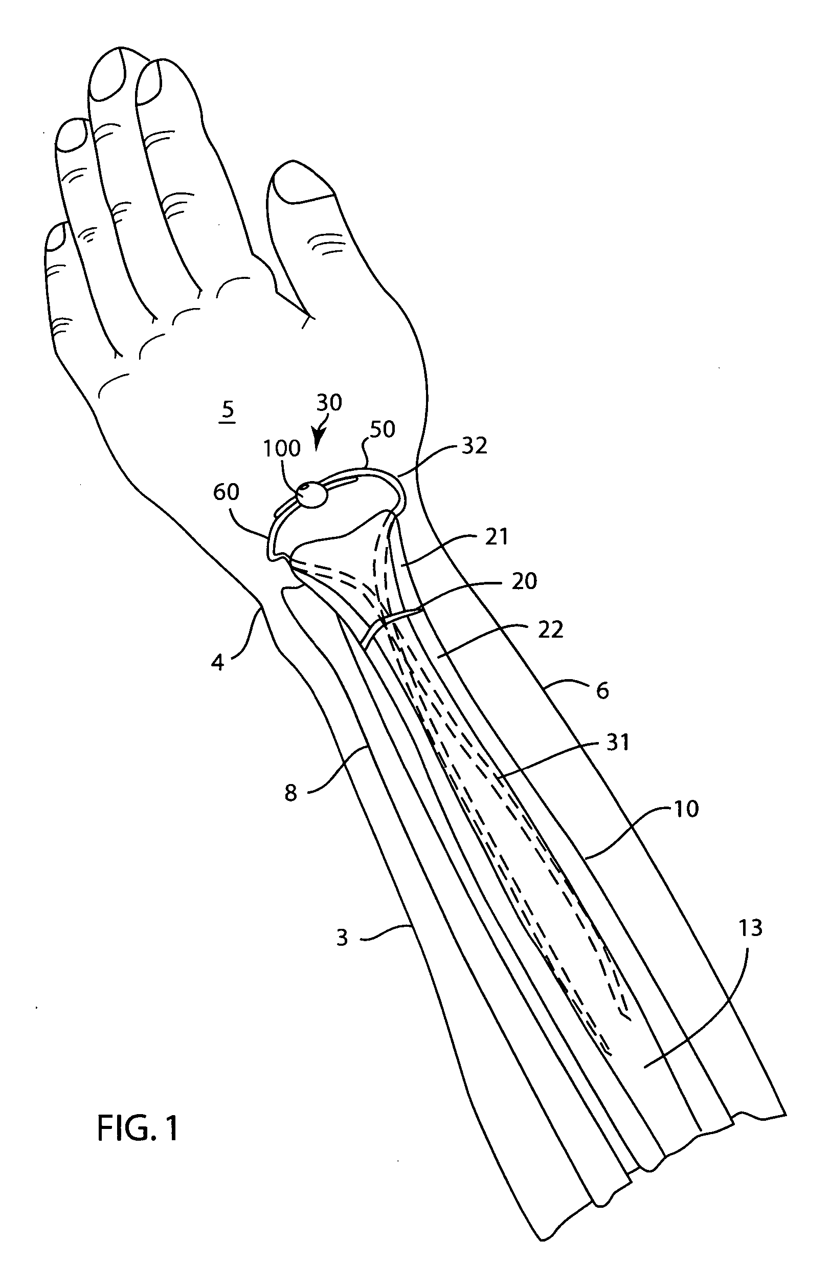 Fixator for a fractured bone