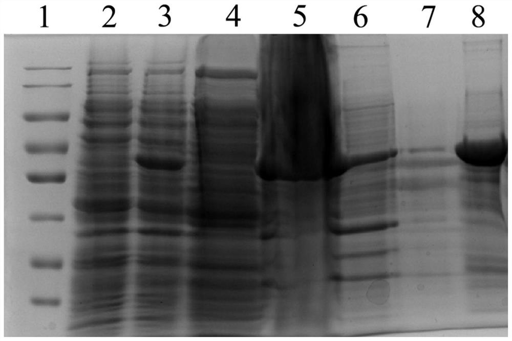 Serum ALDH1B1 autoantibody quantitative detection kit and application thereof