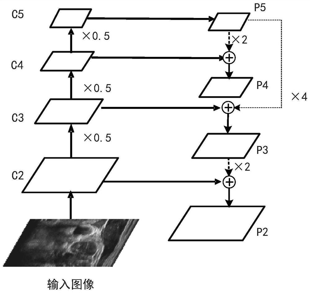 A multi-target recognition method and system for brachial plexus ultrasound images