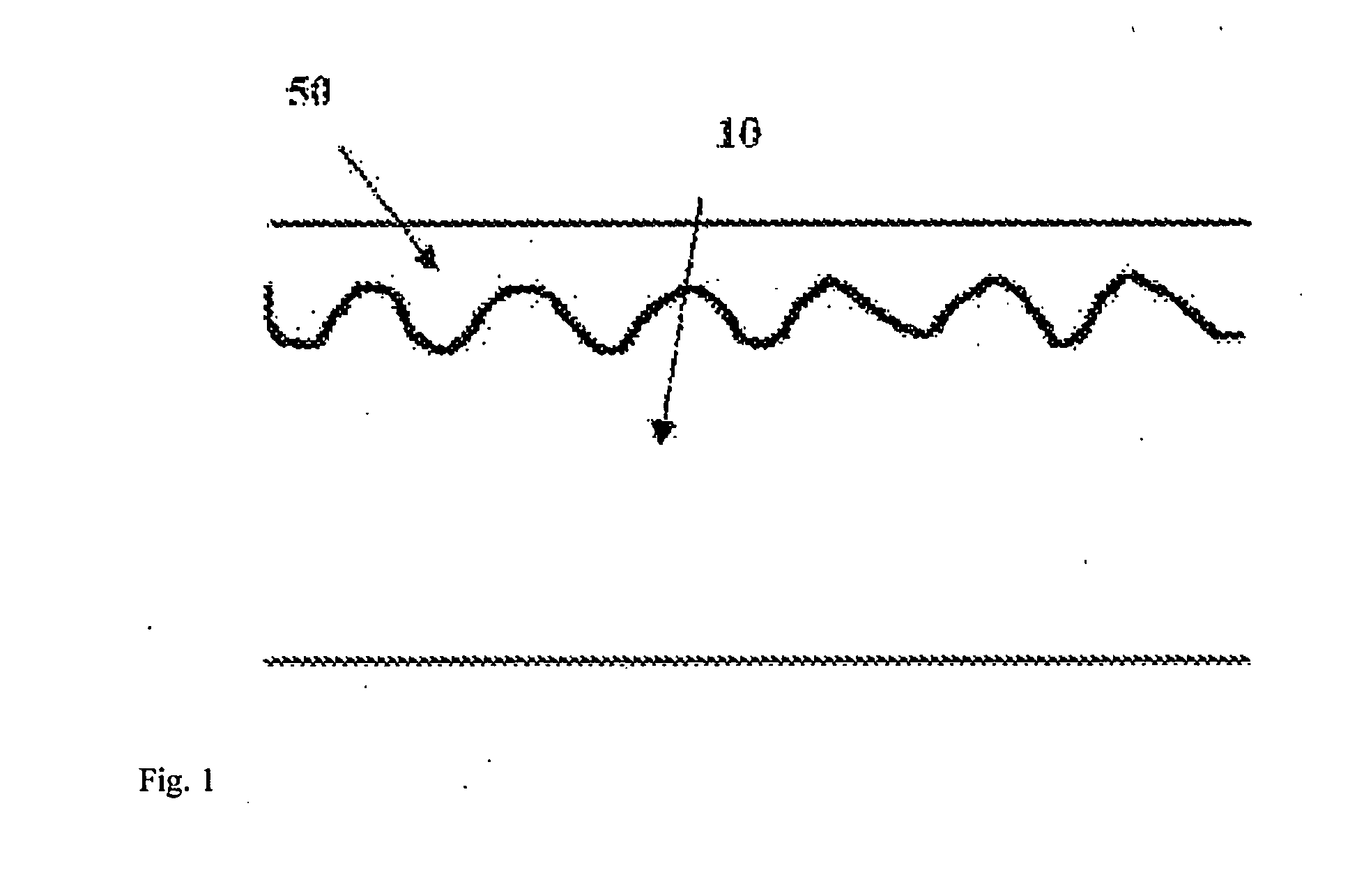 Bioabsorbable Medical Device or Medical Device Component and Preparation Method Thereof