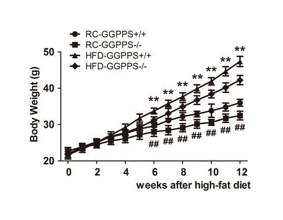 Application of GGPPS genes in preparation of medicines for treating non-alcoholic fatty liver disease