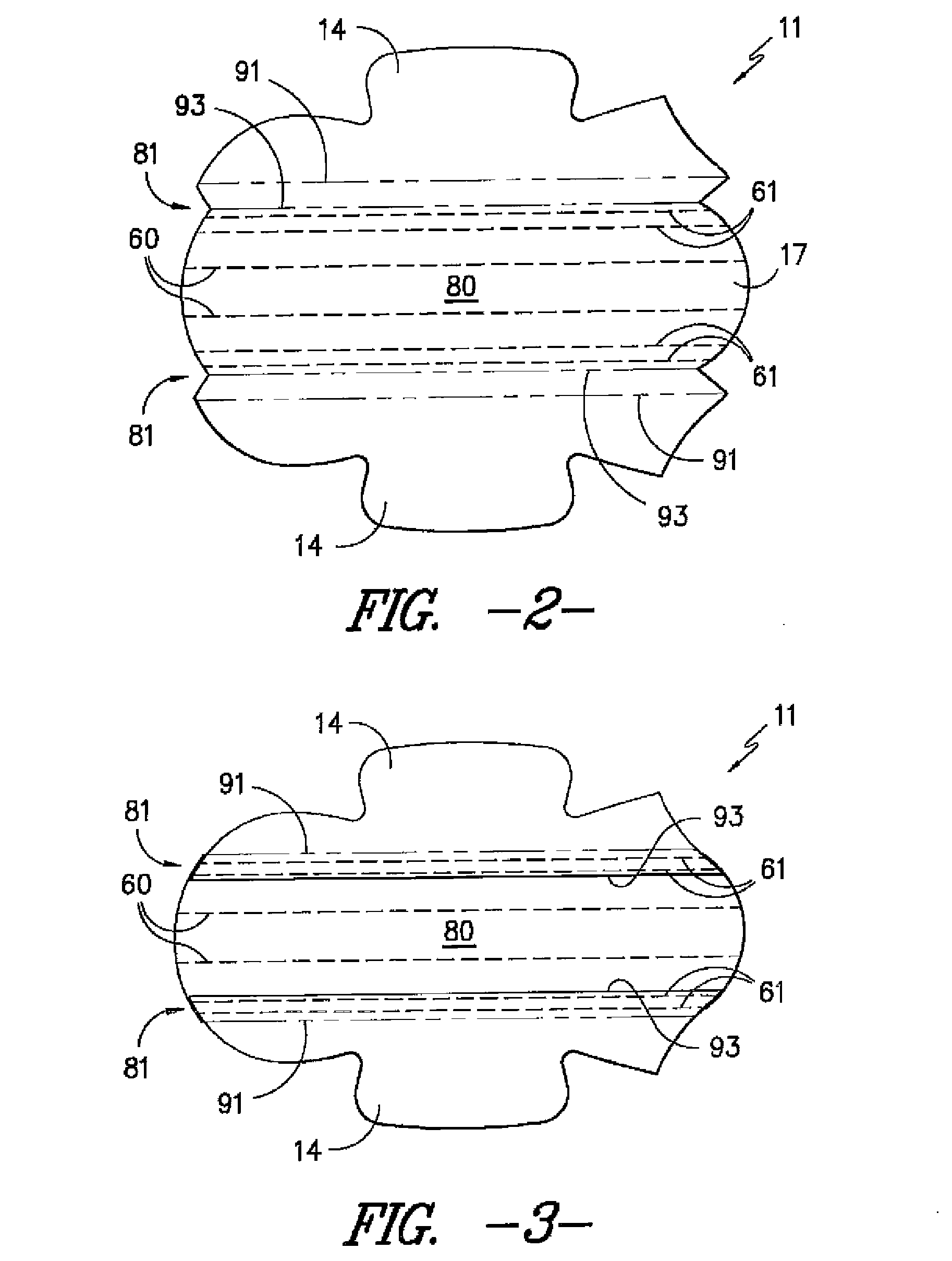 Absorbent Article having Enhanced Leakage Protection