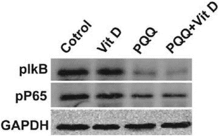 Medicine for preventing and treating sicca syndrome and composition thereof