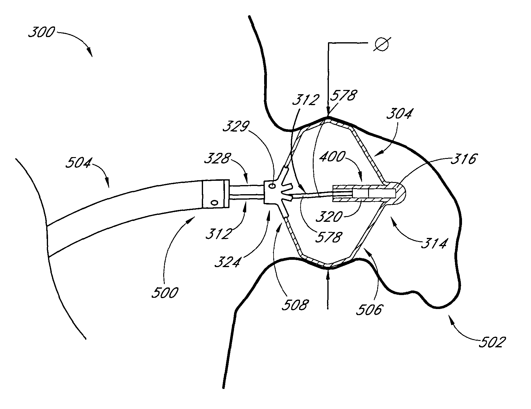 System and method for delivering a left atrial appendage containment device