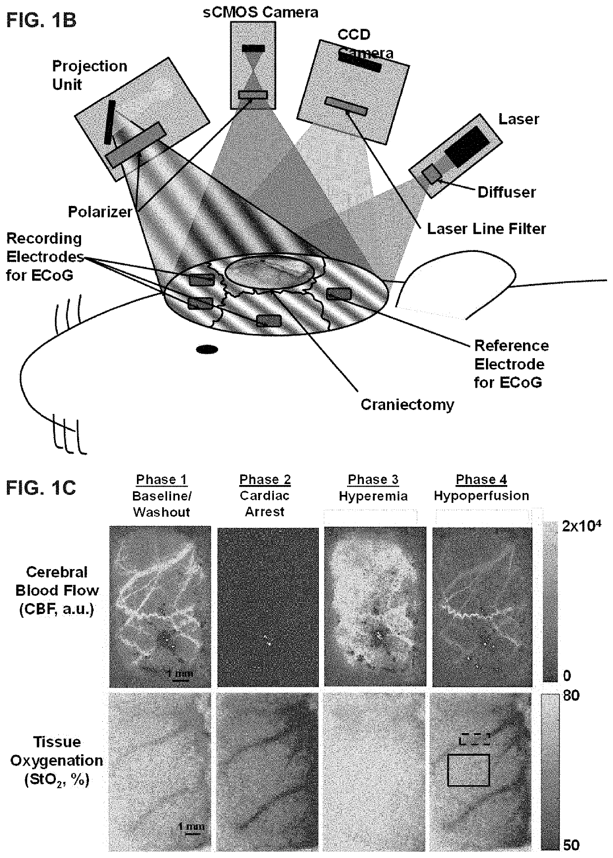 Real-time methods to enable precision-guided cpr to improve neurological outcome and predict brain damage after ischemic injury and reperfusion