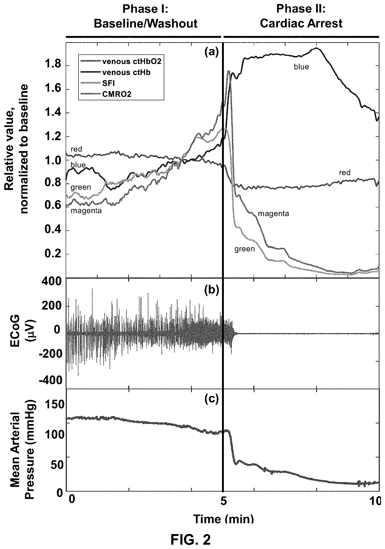 Real-time methods to enable precision-guided cpr to improve neurological outcome and predict brain damage after ischemic injury and reperfusion