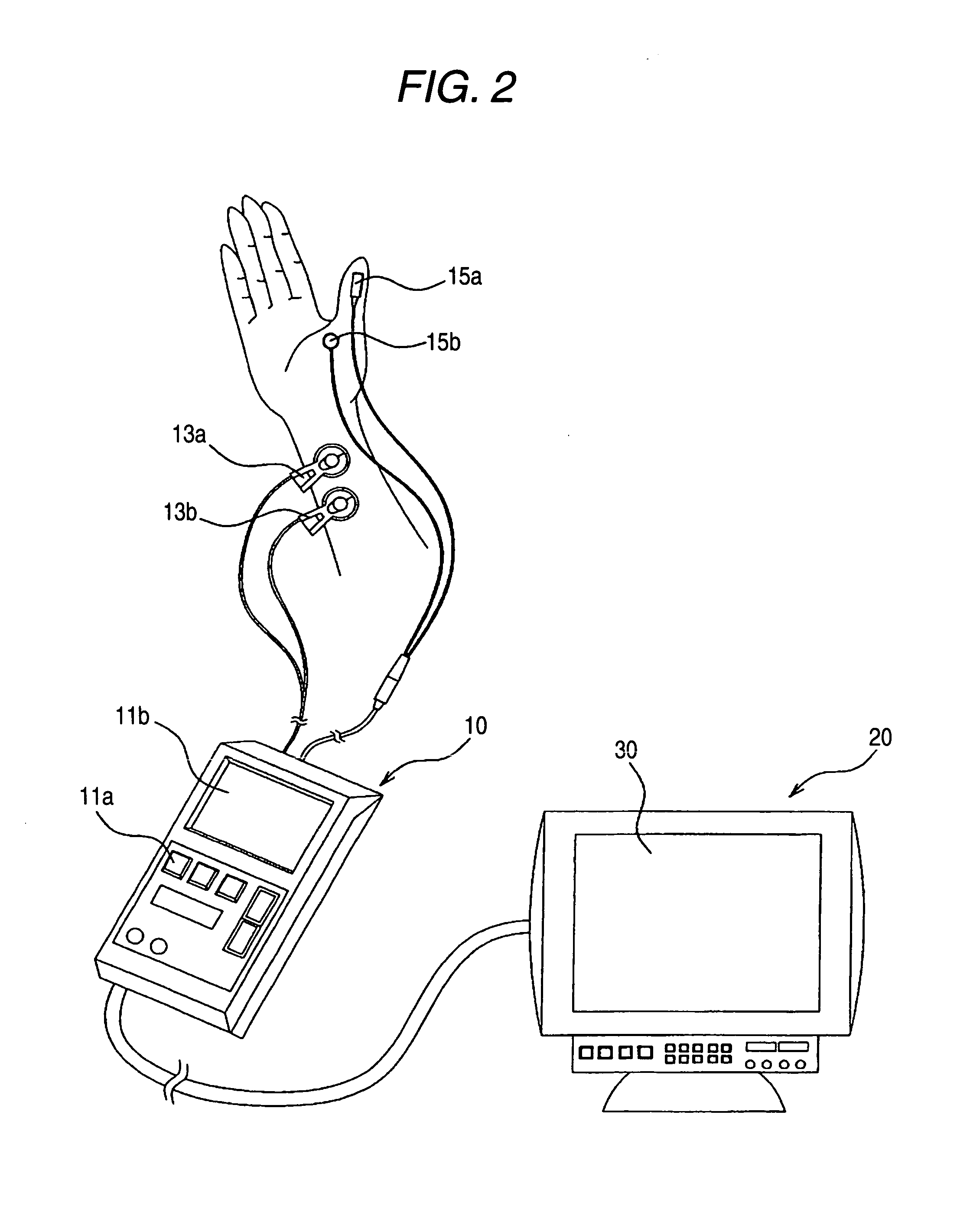 Method and monitor apparatus for displaying parameters indicative of muscle relaxation