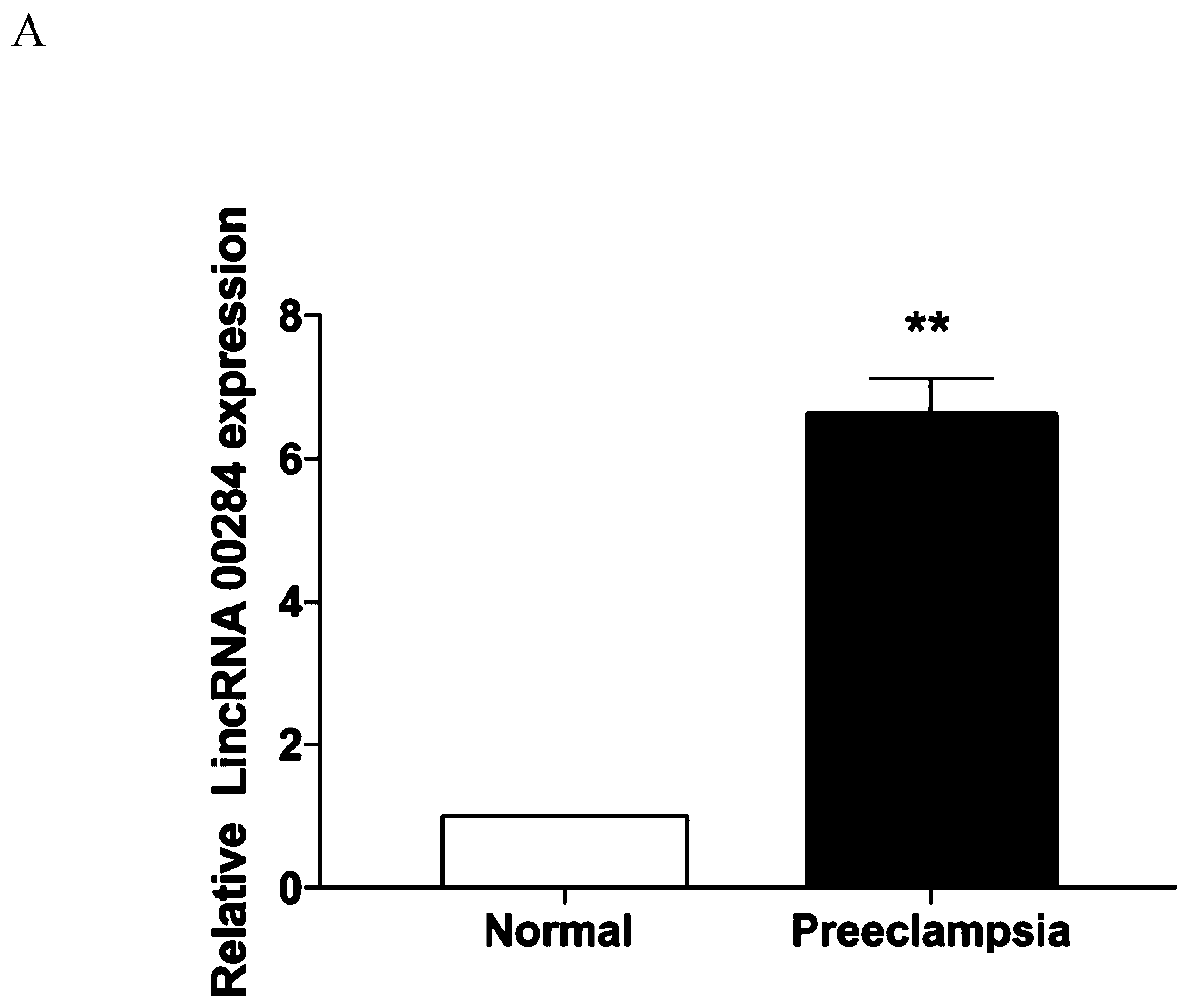 Long non-coding RNA and application of long non-coding RNA in diagnosis of preeclampsia and preparation of target drug for curing preeclampsia