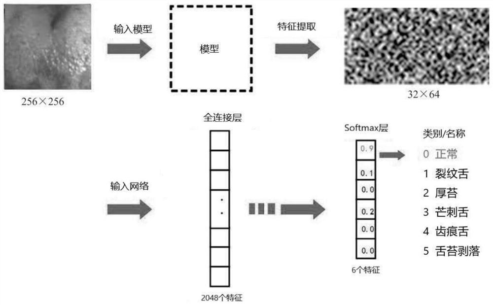 Tongue coating detection system based on convolutional neural network