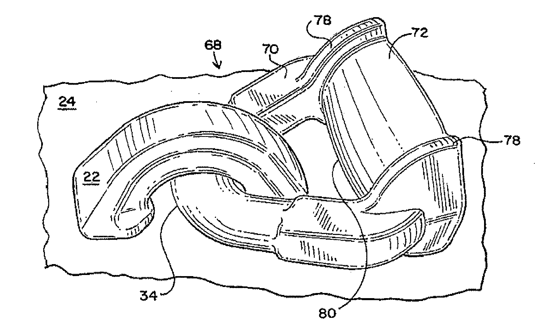 Lading tie anchor link with enhanced banding contact surface