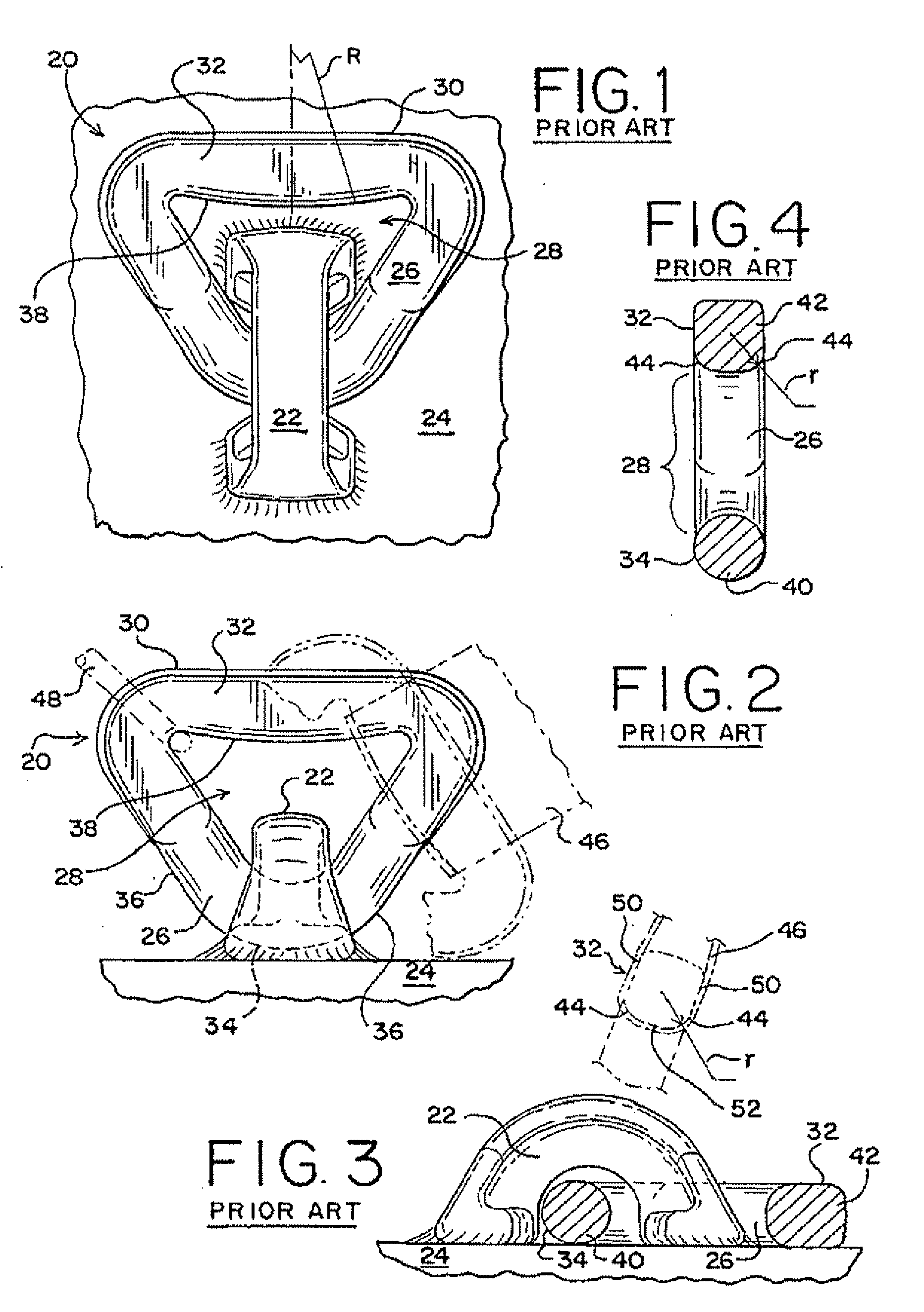 Lading tie anchor link with enhanced banding contact surface