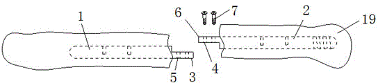 Minimally invasive intramedullary fixing device for clavicle fracture