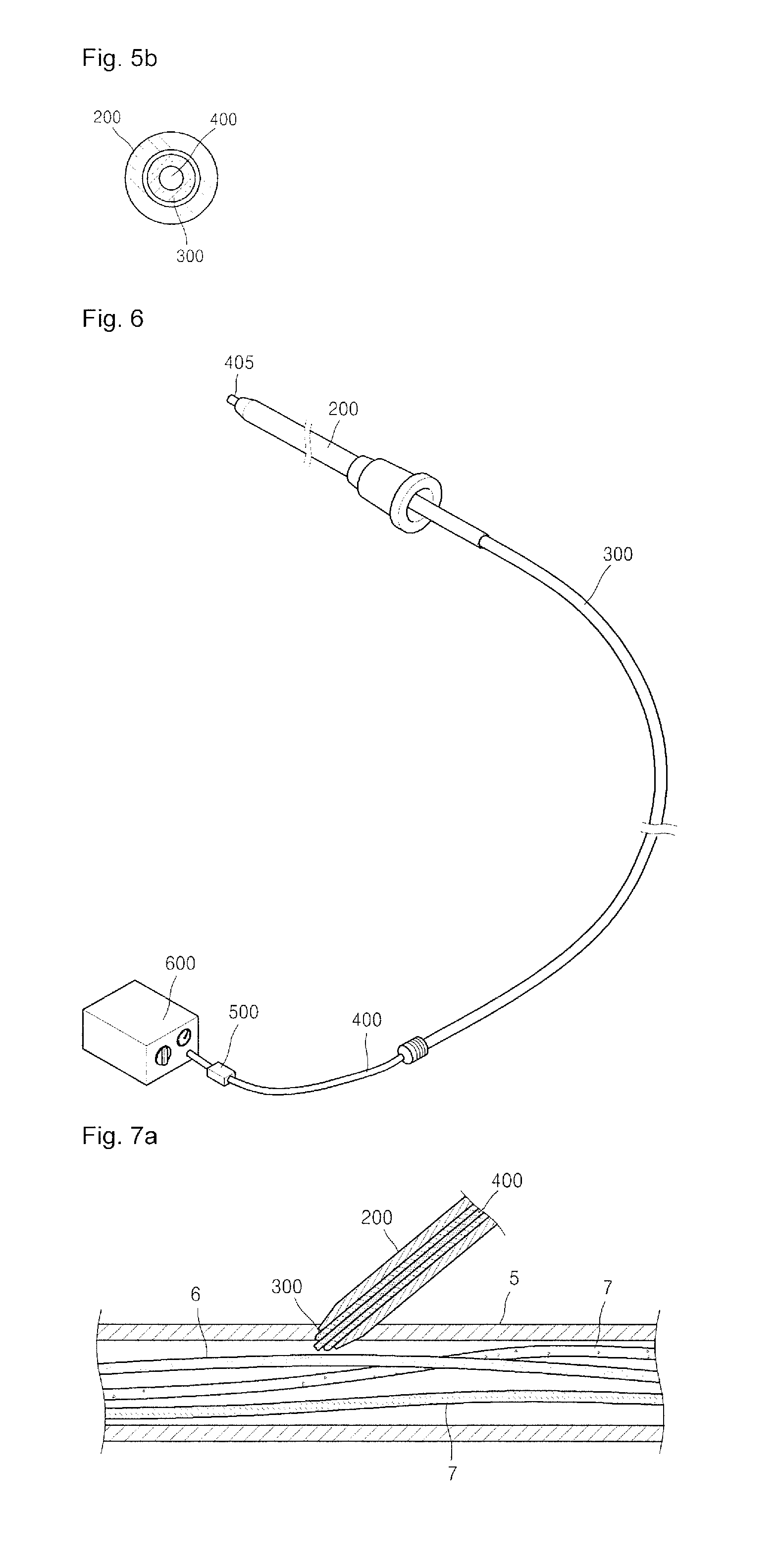 Catheter set comprising guide wire