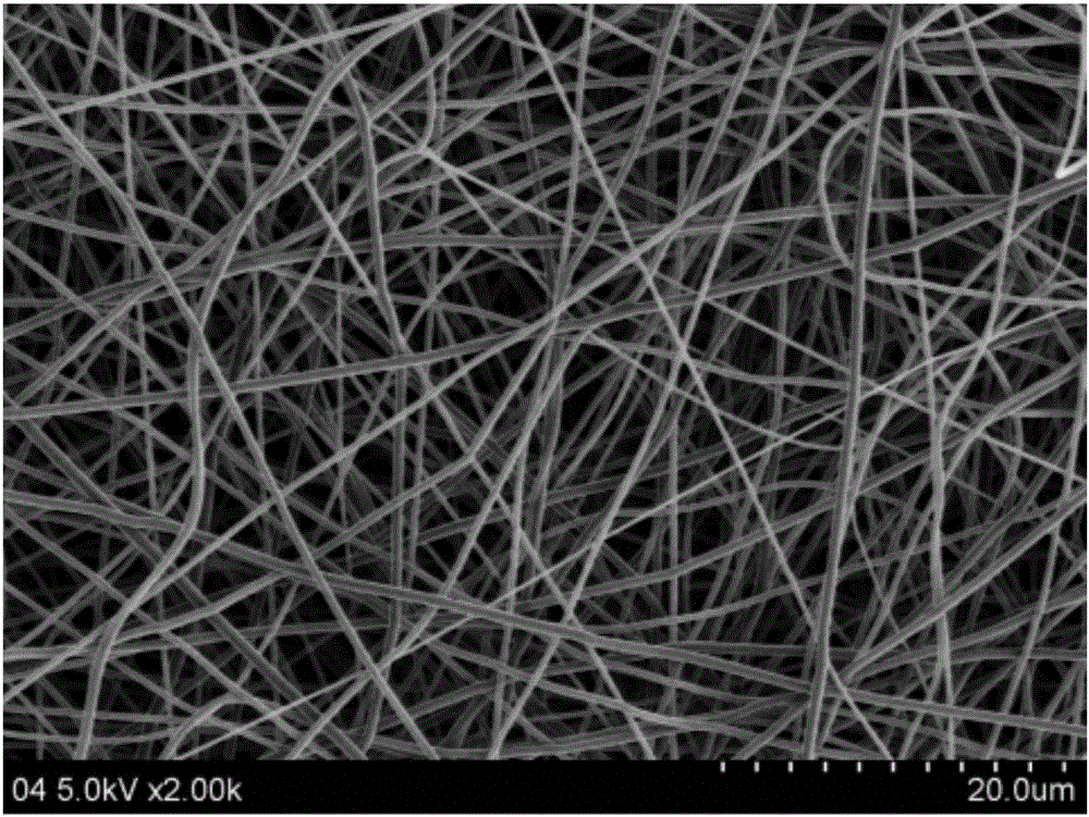 Preparation method of carnosol and chitosan composite nanometer fiber mat
