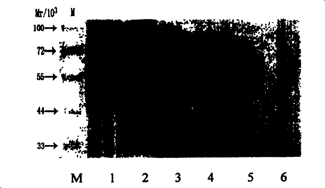 Preparation method of CYP1A2 polypeptide and antihuman CYP1A2 polypeptide antibody