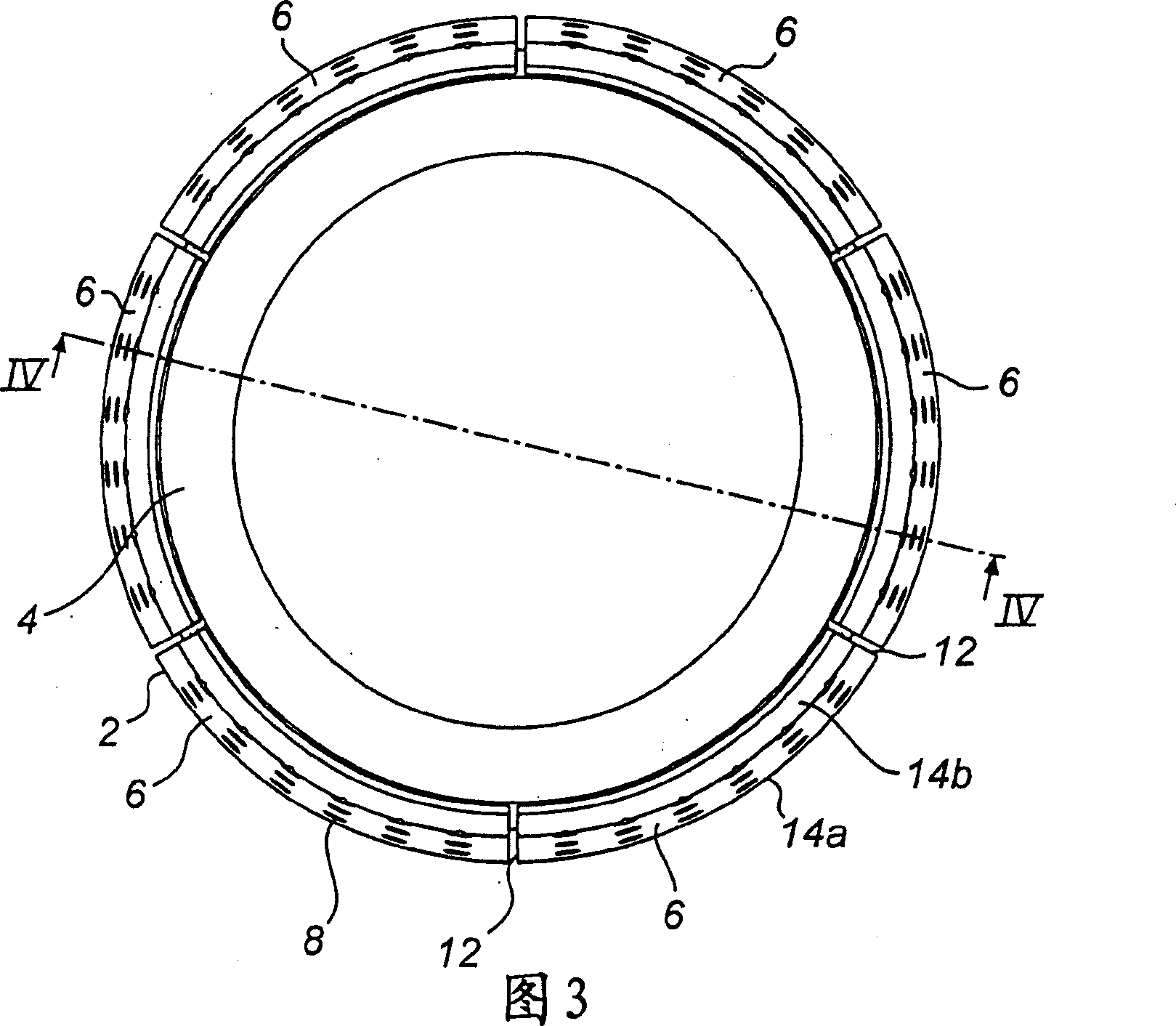 Apparatus and method for focusing a radiotherapy field, where slidable plates on the collimator ring controls the collimator