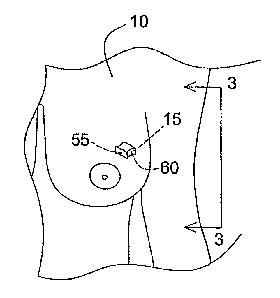 Method of identifying the orientation of a tissue sample