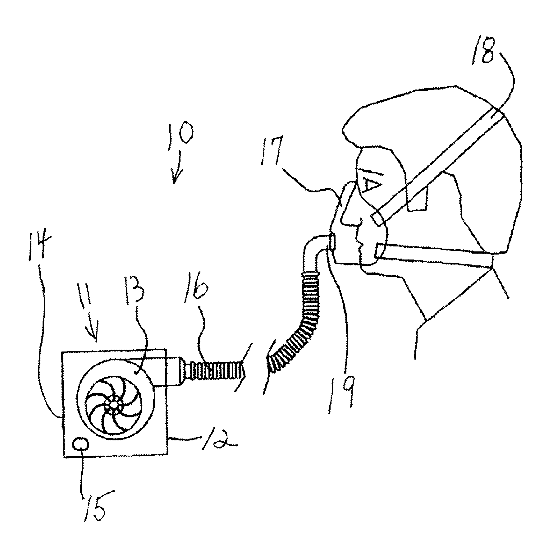 Method of relieving pain associated with fractured ribs