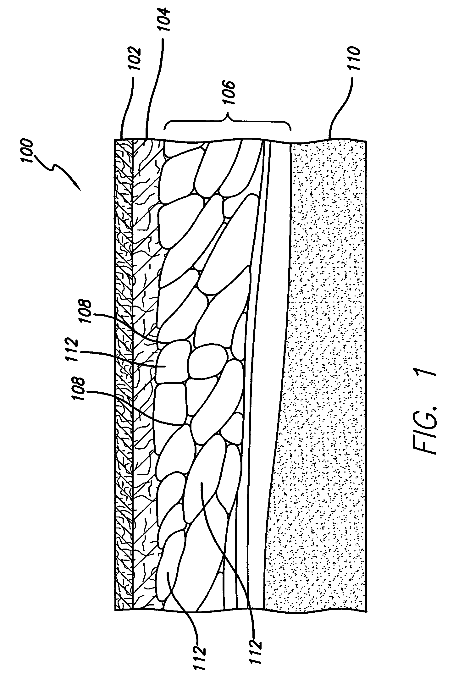 Methods and system for treating subcutaneous tissues