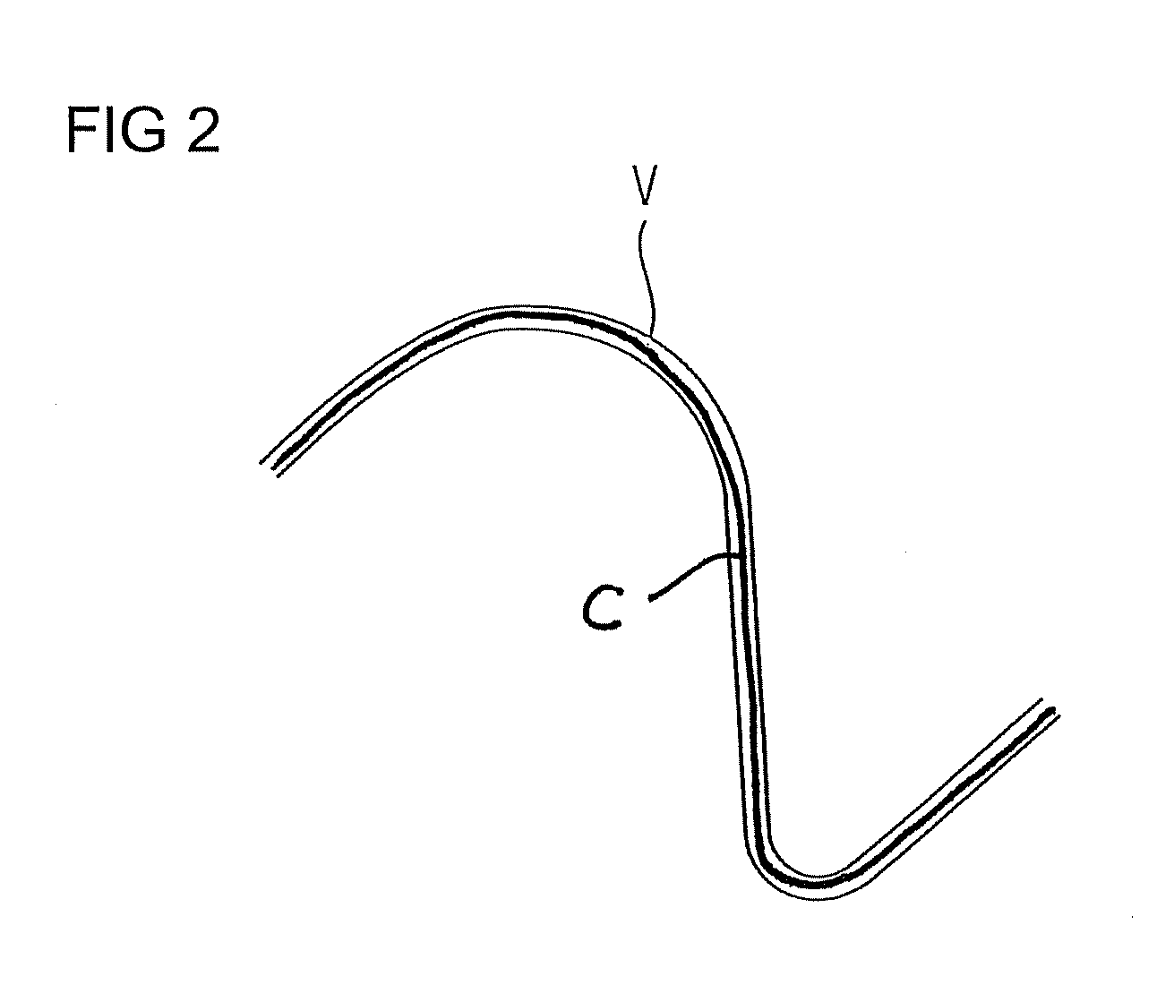 Hearing device and corresponding method for inserting the hearing device