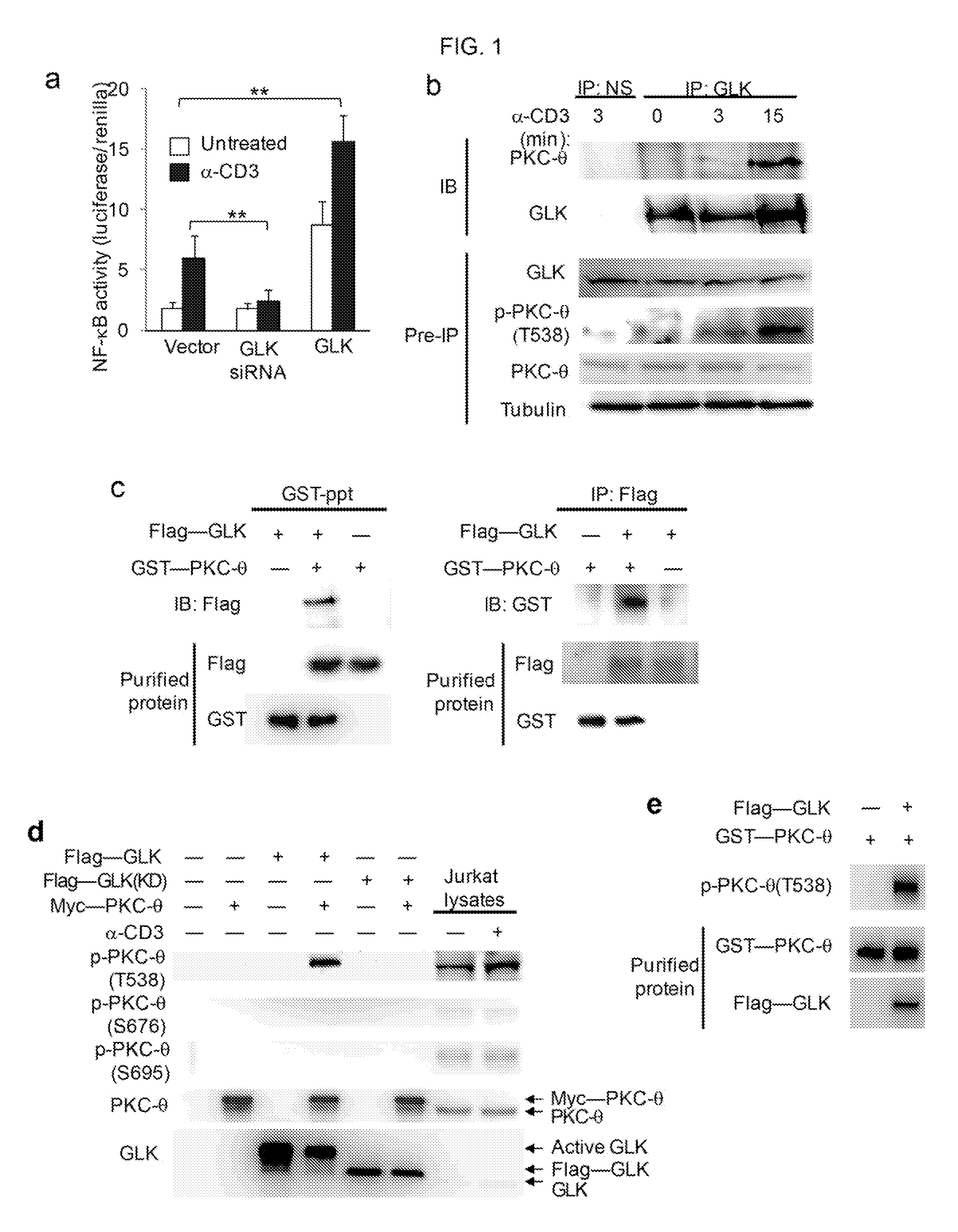 Map kinase kinase kinase kinase 3 (map4k3) as a biomarker and therapetic target for autoimmune disease, cancer, inflammation and il-17-associated disease