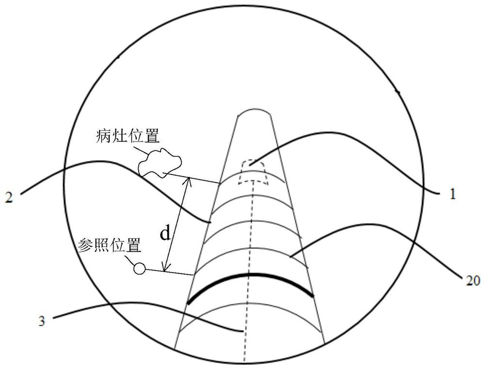 Ultrasound micro-probe, ultrasound endoscopy system and biopsy sampling system