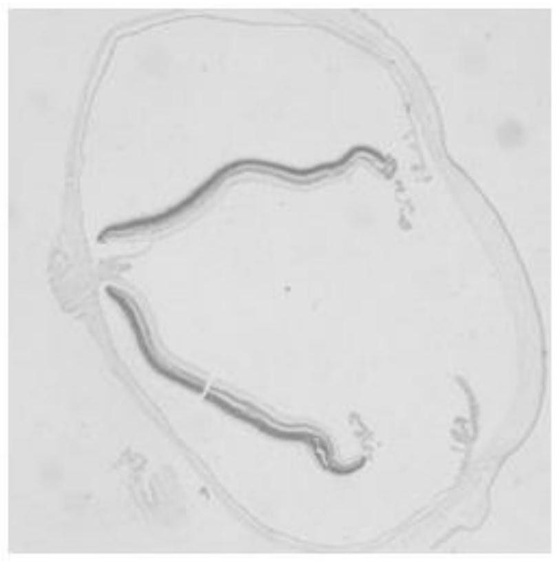 A fixative solution for eyeball tissue and a pretreatment method for making slices of eyeball tissue