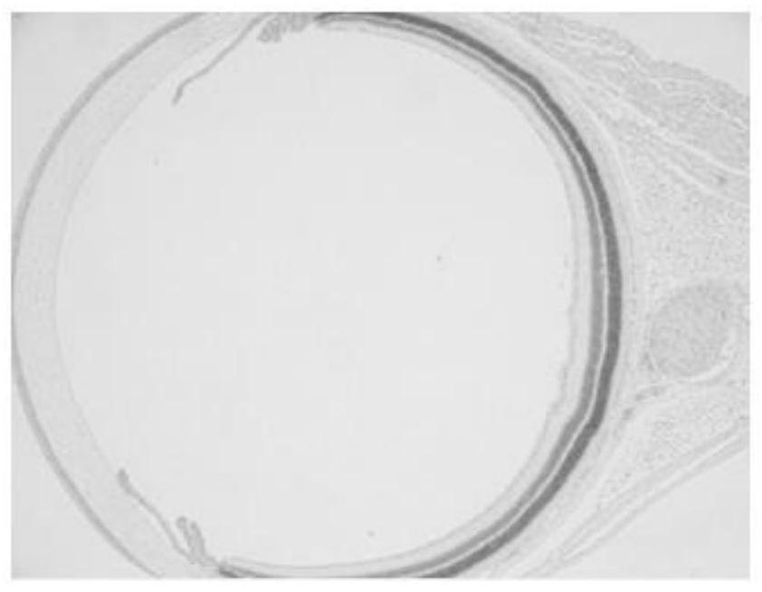 A fixative solution for eyeball tissue and a pretreatment method for making slices of eyeball tissue