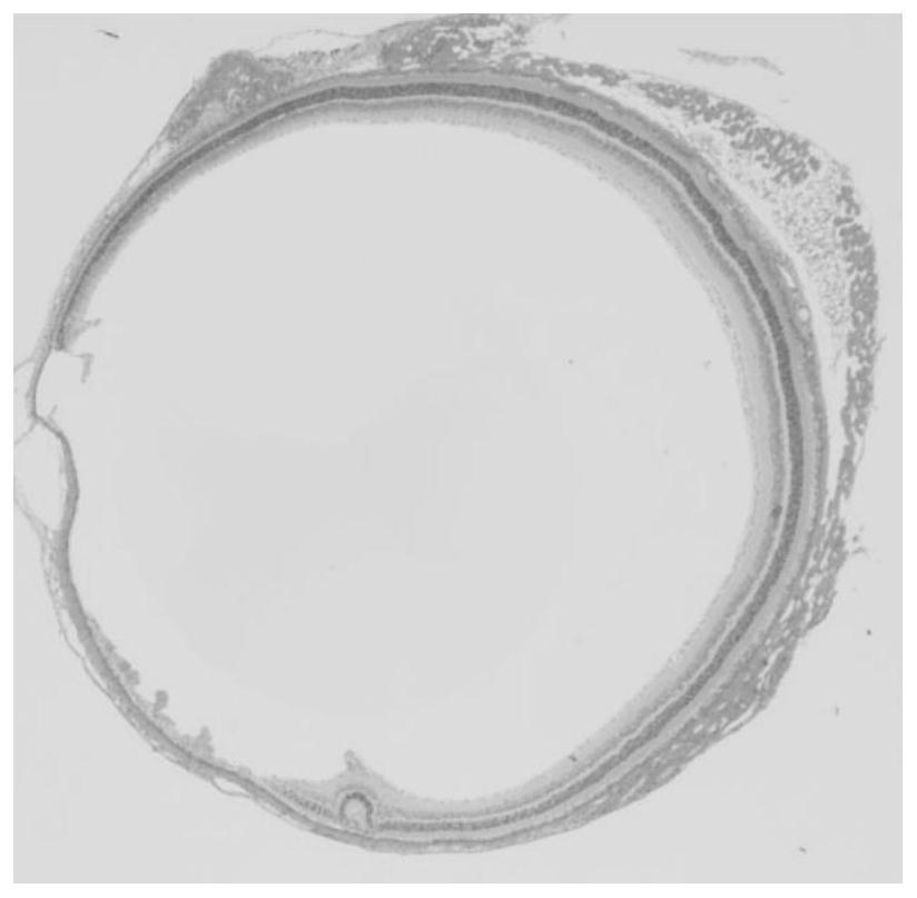 A fixative solution for eyeball tissue and a pretreatment method for making slices of eyeball tissue