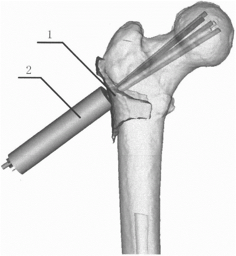 Medullary core three-dimensional decompressing device for treating avascular necrosis of femoral head as well as preparing and testing methods based on medullary core three-dimensional decompressing device