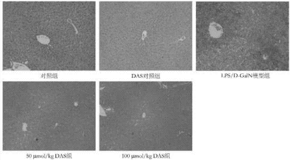 Application of DAS (Diallyl Sulfide) in preparation of medicine for preventing/ or treating LPS (Lipopolysaccharide)/D-GalN-induced acute immune liver injury