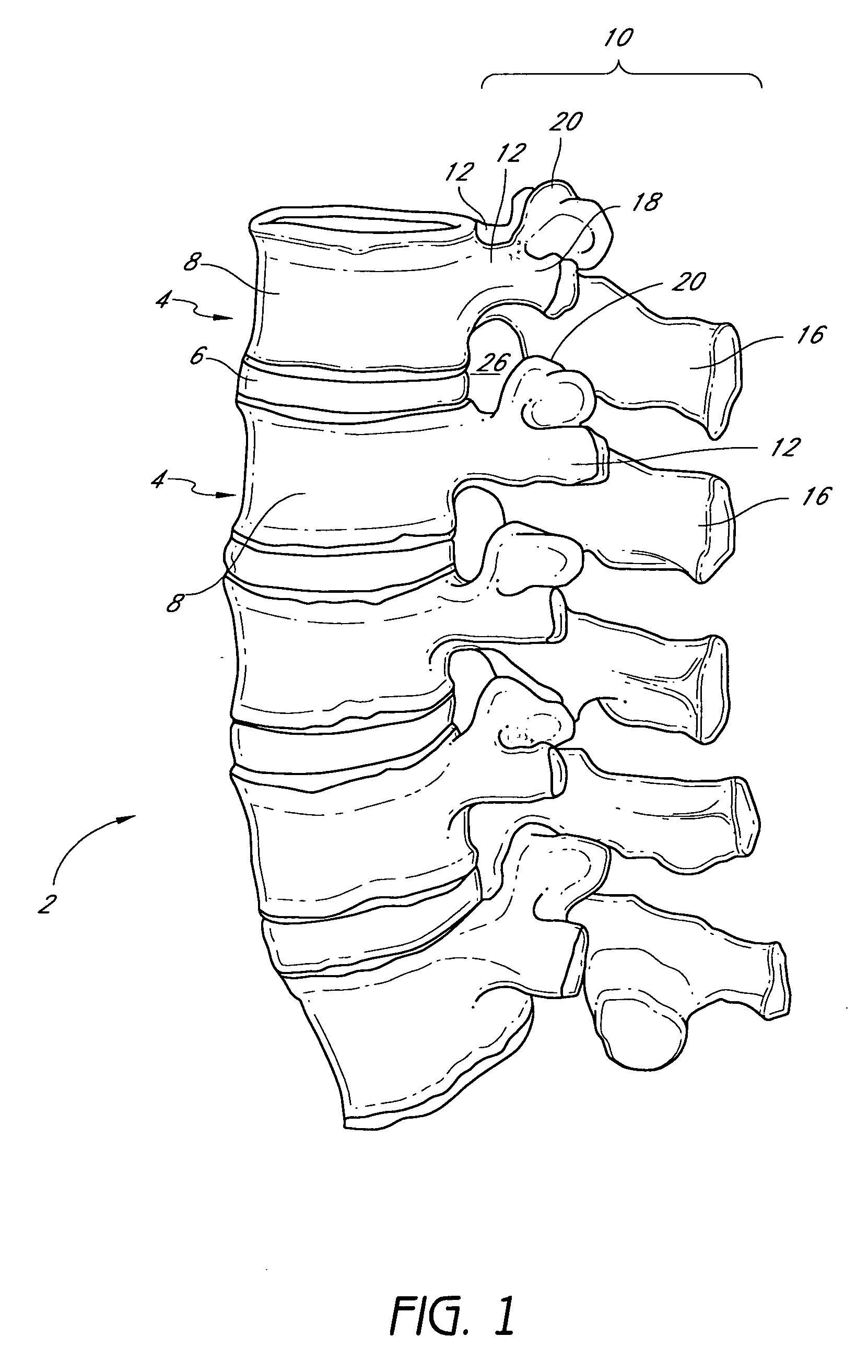 System and method for protecting neurovascular structures