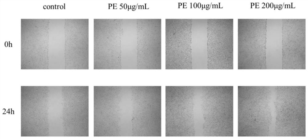 Application of pedicel glucoside in the preparation of anti-diabetic skin ulcer medicine