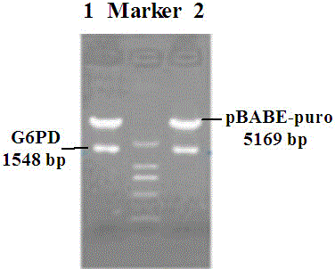 G6PD over-expressed ACHN stable cell strain and construction method thereof