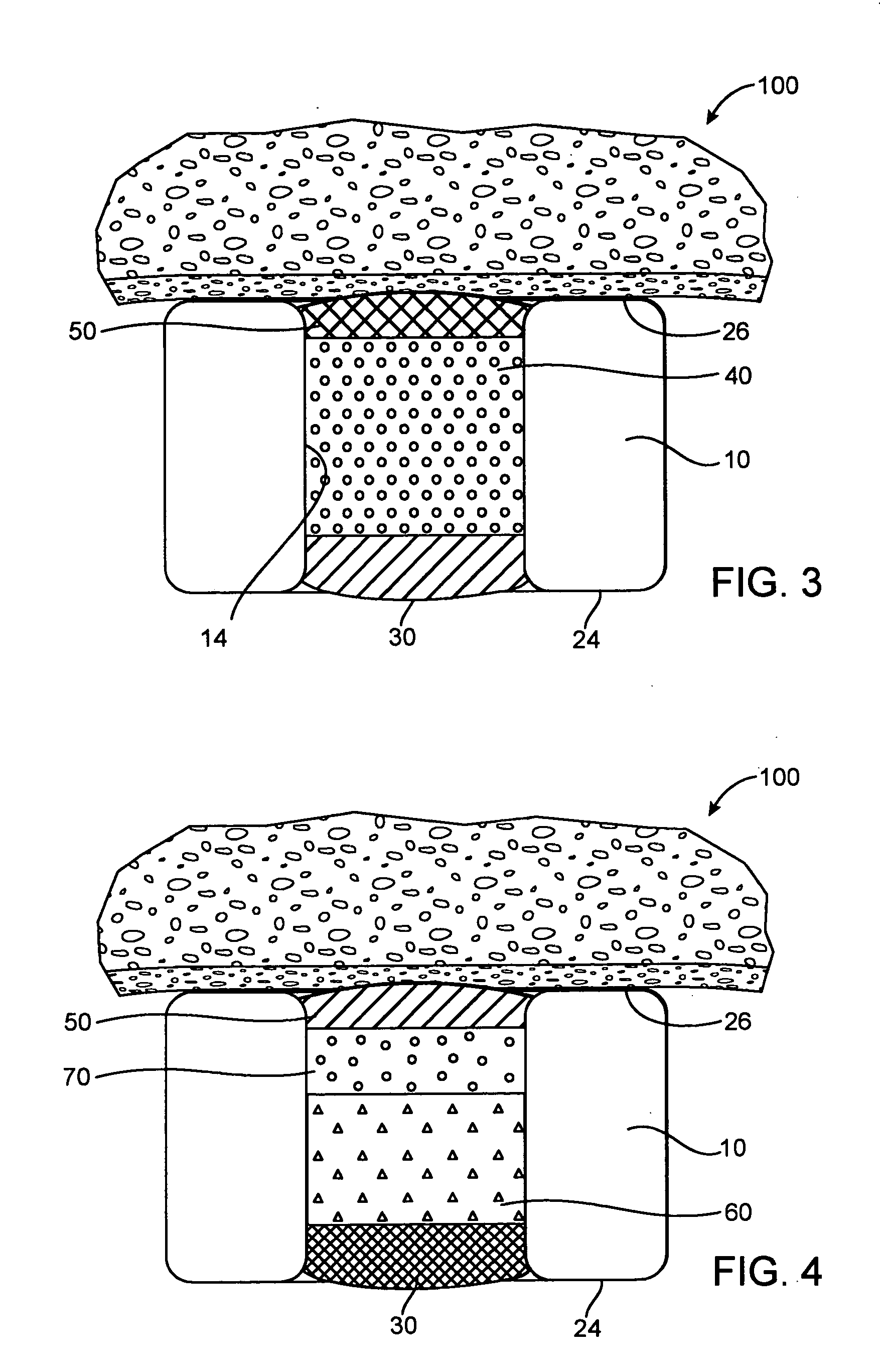 Expandable medical device with beneficial agent matrix formed by a multi solvent system