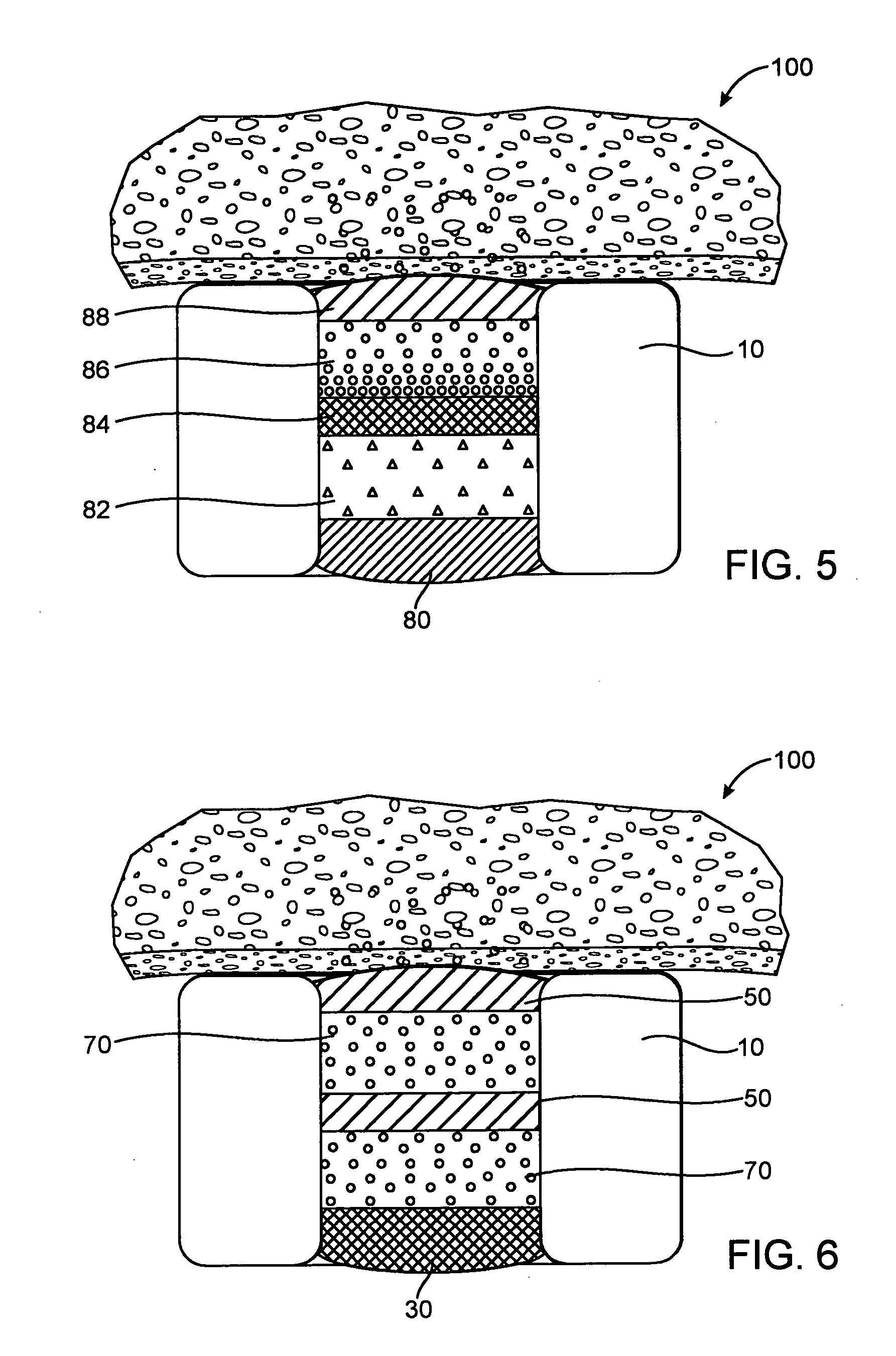Expandable medical device with beneficial agent matrix formed by a multi solvent system