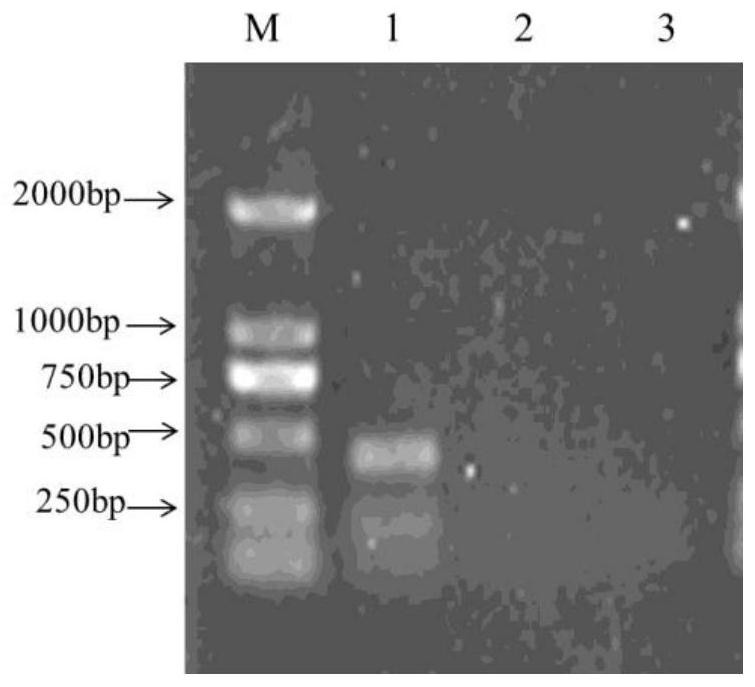 An immunoprotective Photobacterium mermaid hemolysin hly  <sub>ch</sub> protein