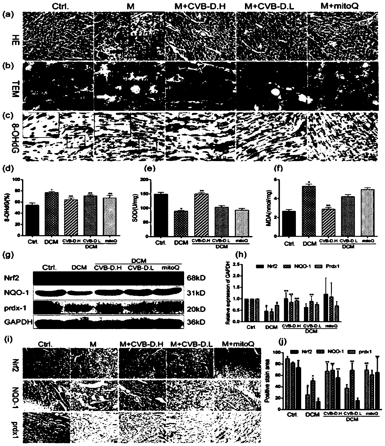 Application of Nrf2-based cyclovirobuxinum D in diabetic cardiomyopathy