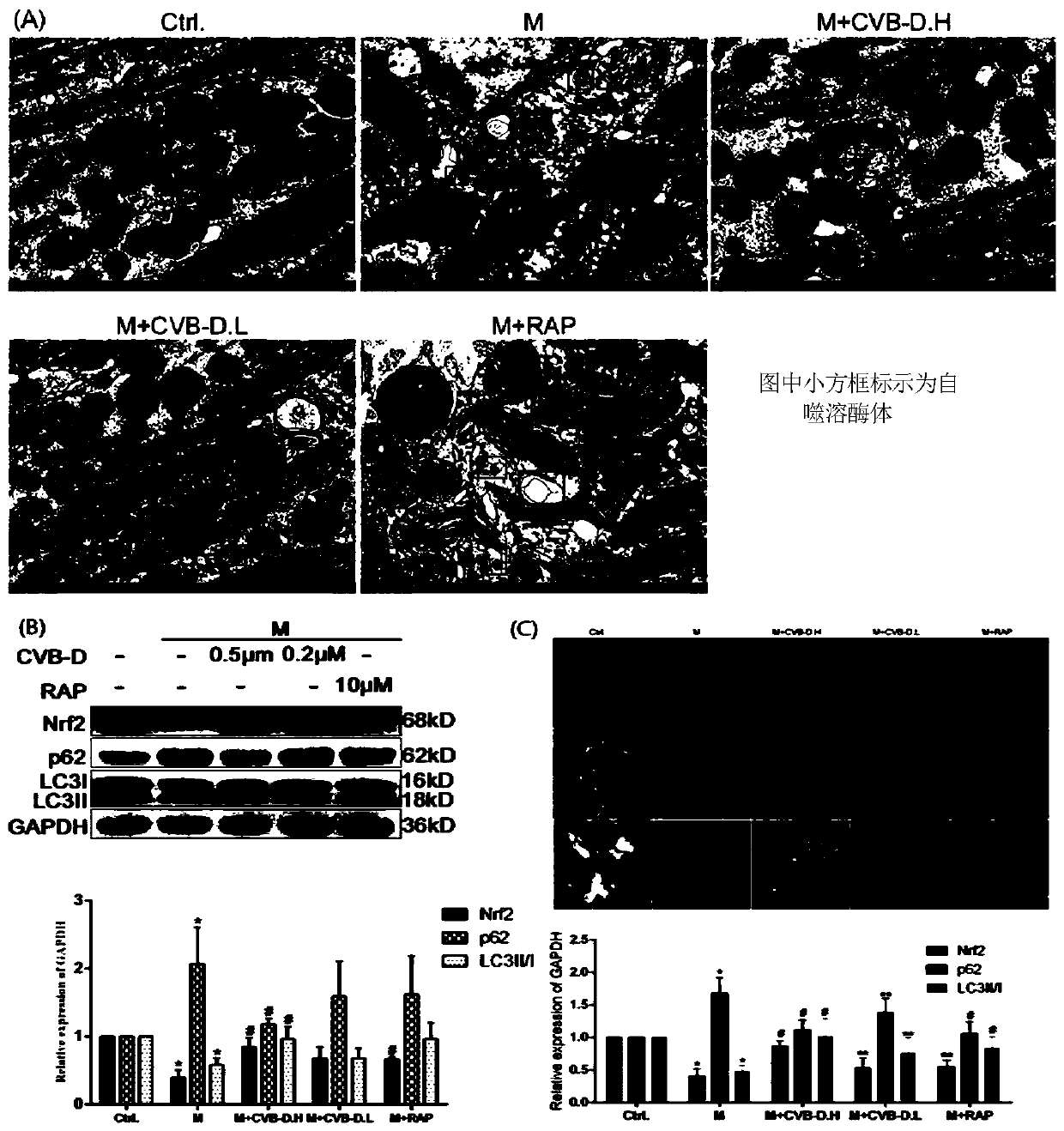 Application of Nrf2-based cyclovirobuxinum D in diabetic cardiomyopathy