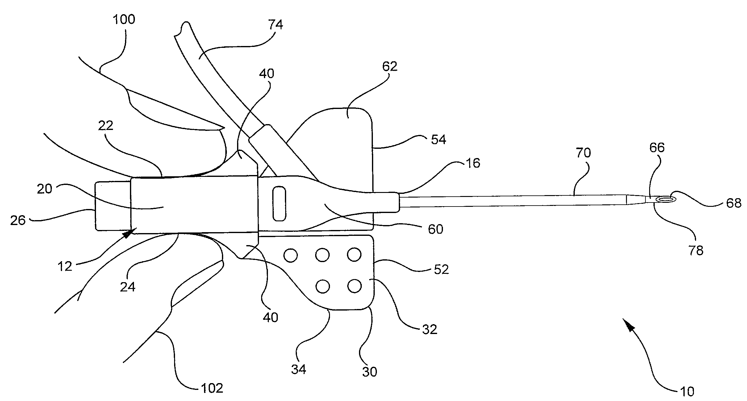 Systems and methods for providing a conventional integrated catheter with universal grip