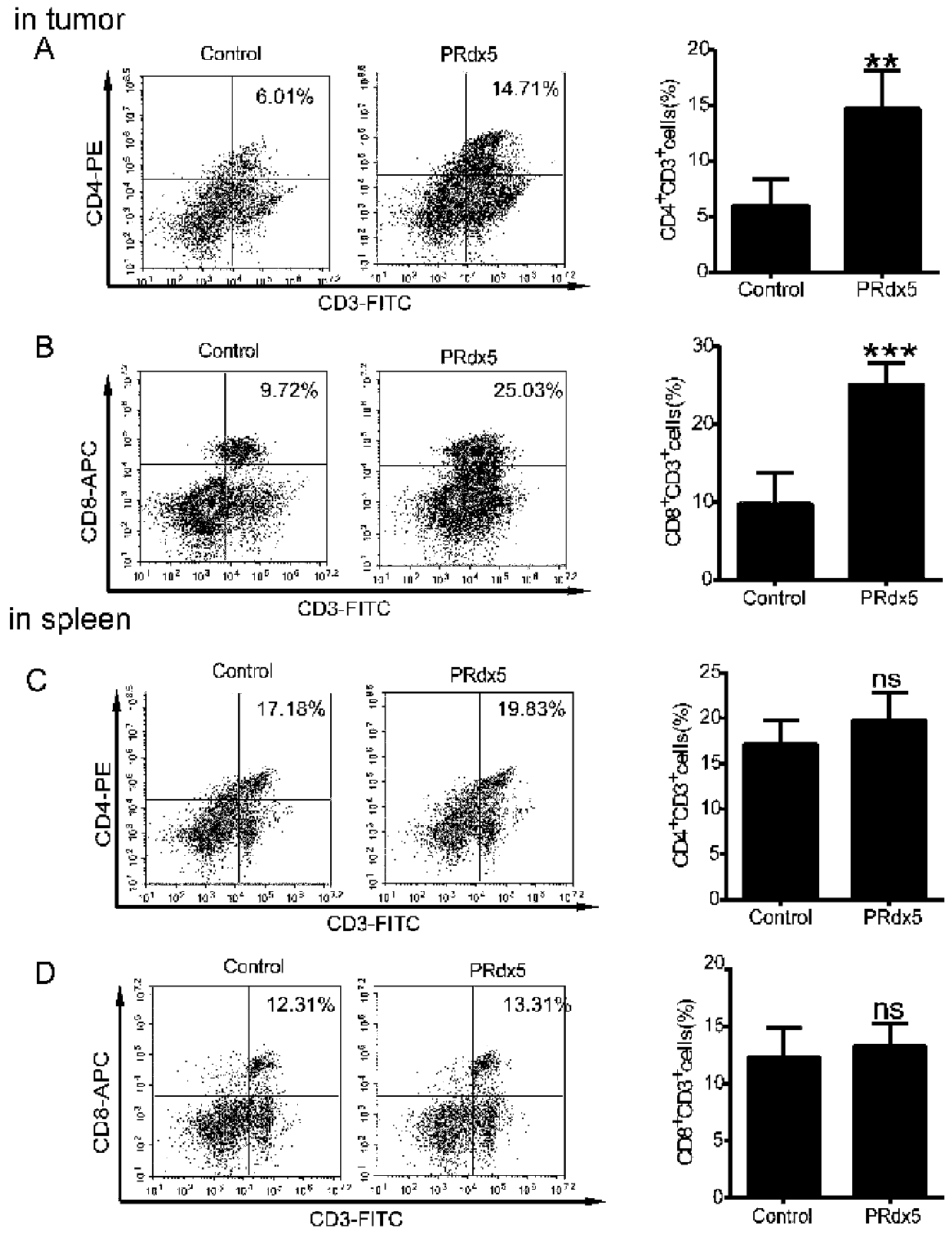Host factor hPRDX5 with anti-tumor effect, encoding gene and application of host factor