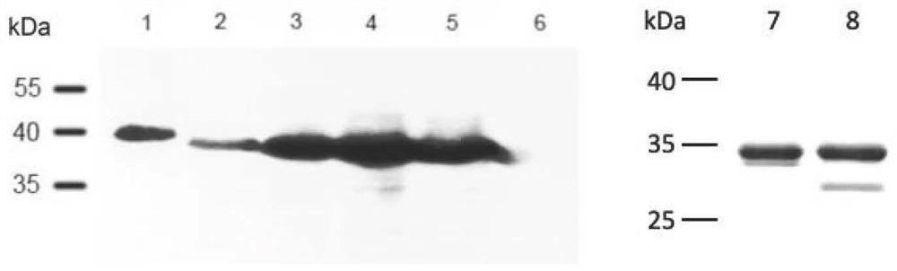 Novel coronavirus S protein receptor binding domain fusion protein containing oligomerization structural domain and application of novel coronavirus S protein receptor binding domain fusion protein