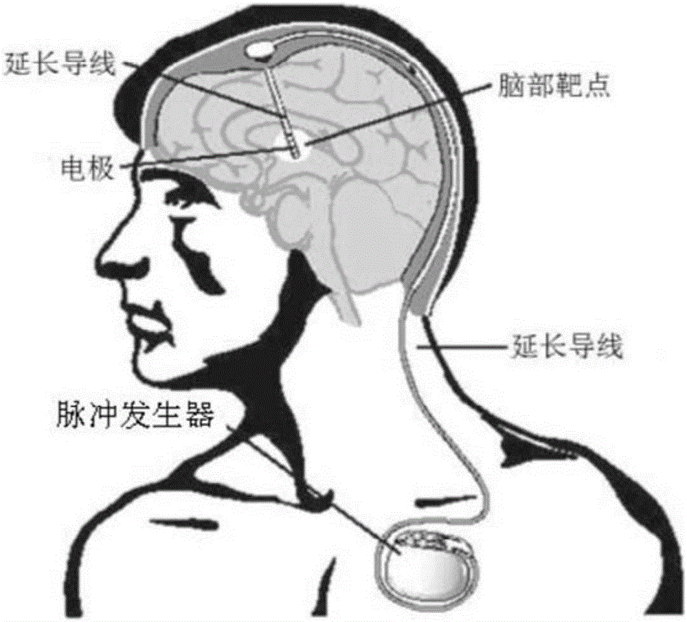 Power monitoring method and power monitoring system of deep brain stimulator