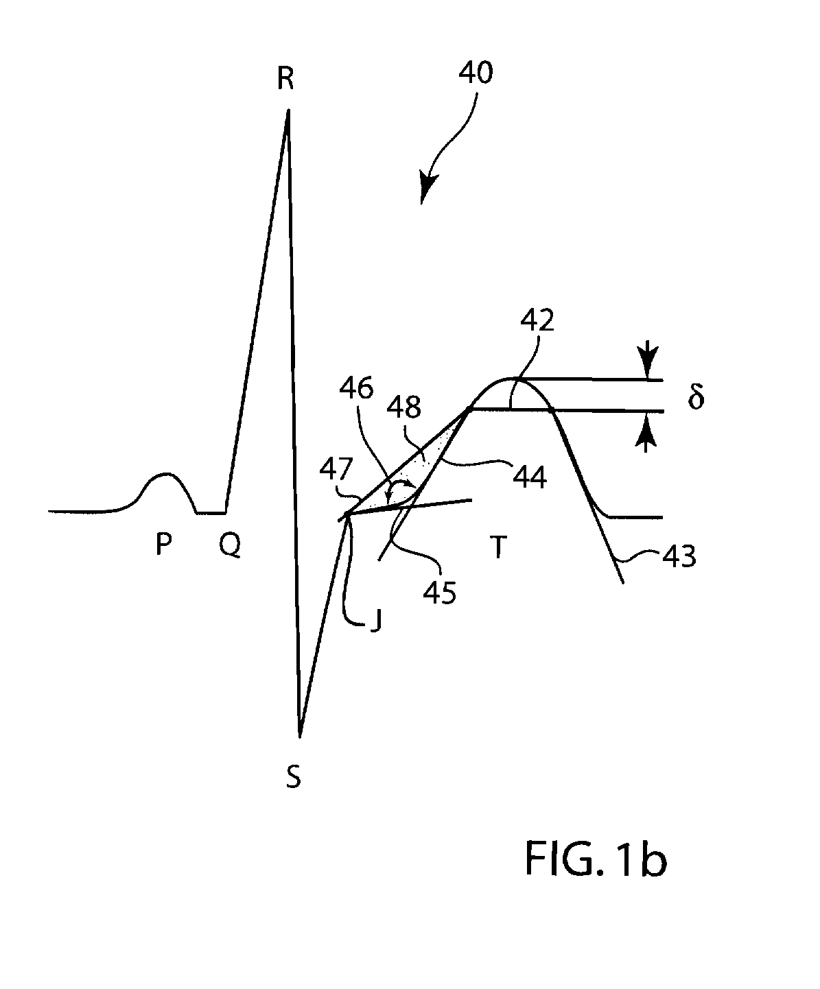 Method of physiological data analysis and measurement quality check using principal component analysis