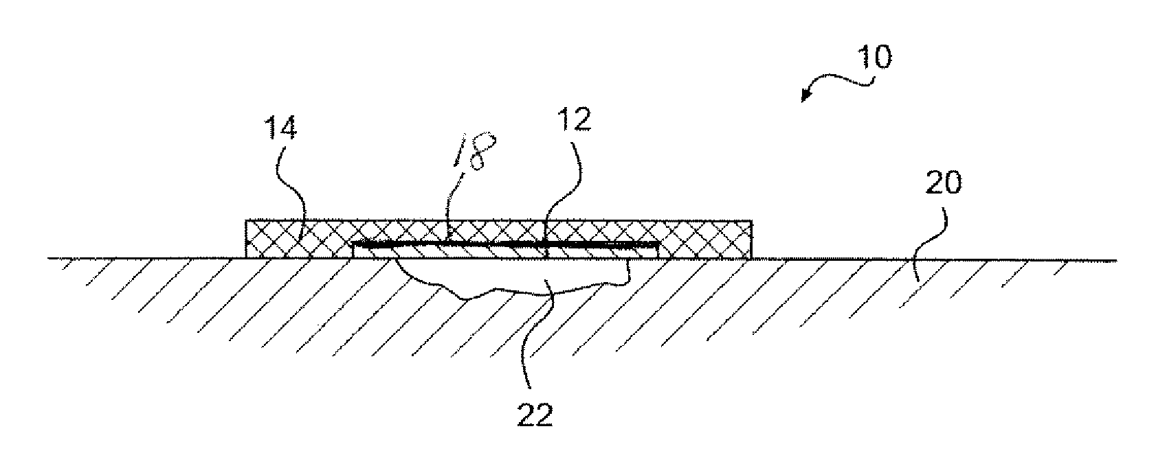 Device and method for healing wounds