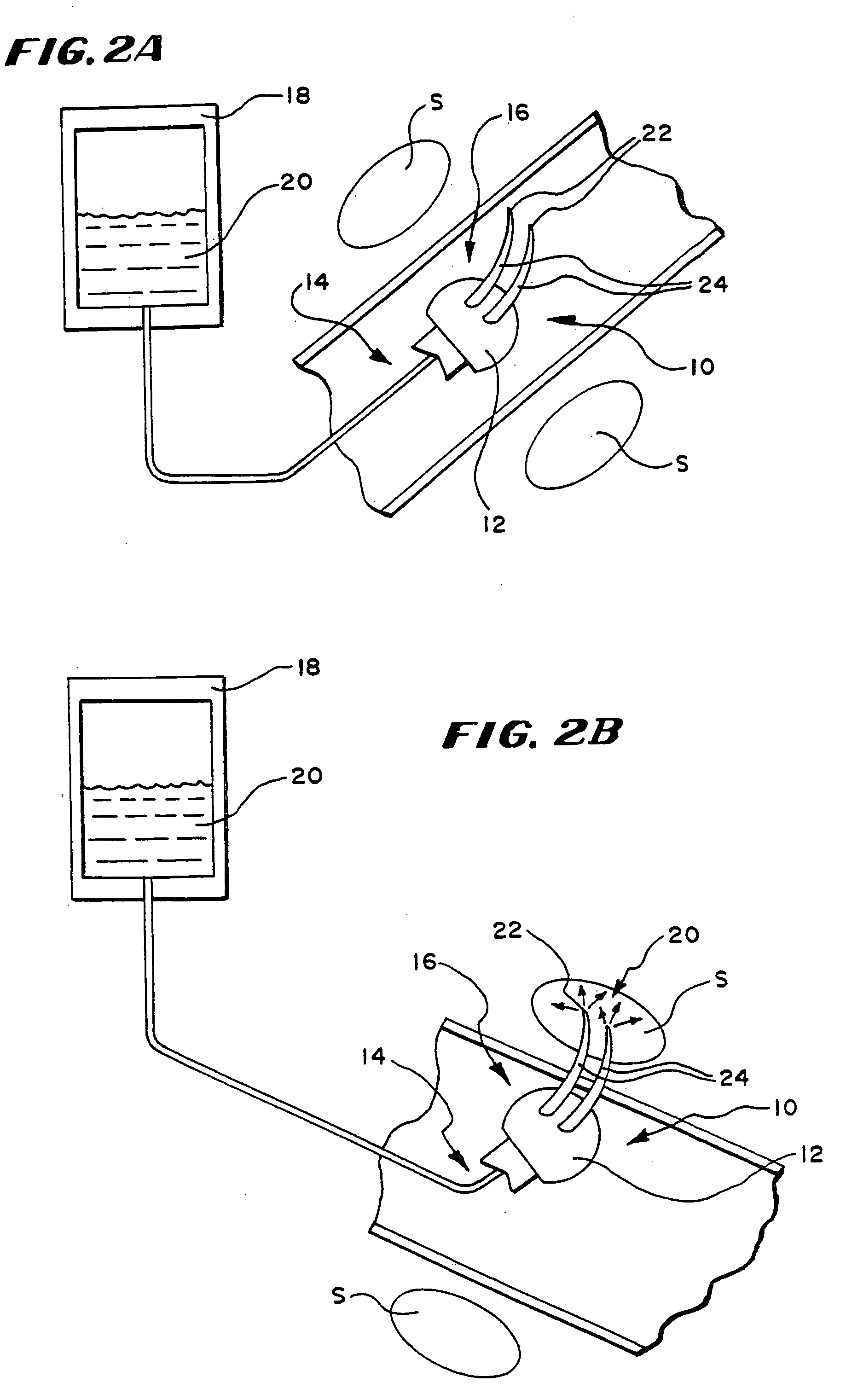 Systems methods for applying a selected treatment agent into contact with tissue to treat sphincter dysfunction