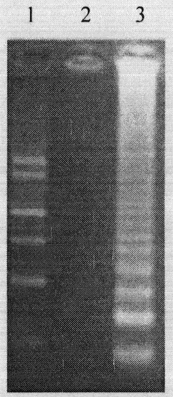 Method for detecting chlamydia pneumoniae by loop-mediated isothermal amplification and detection kit