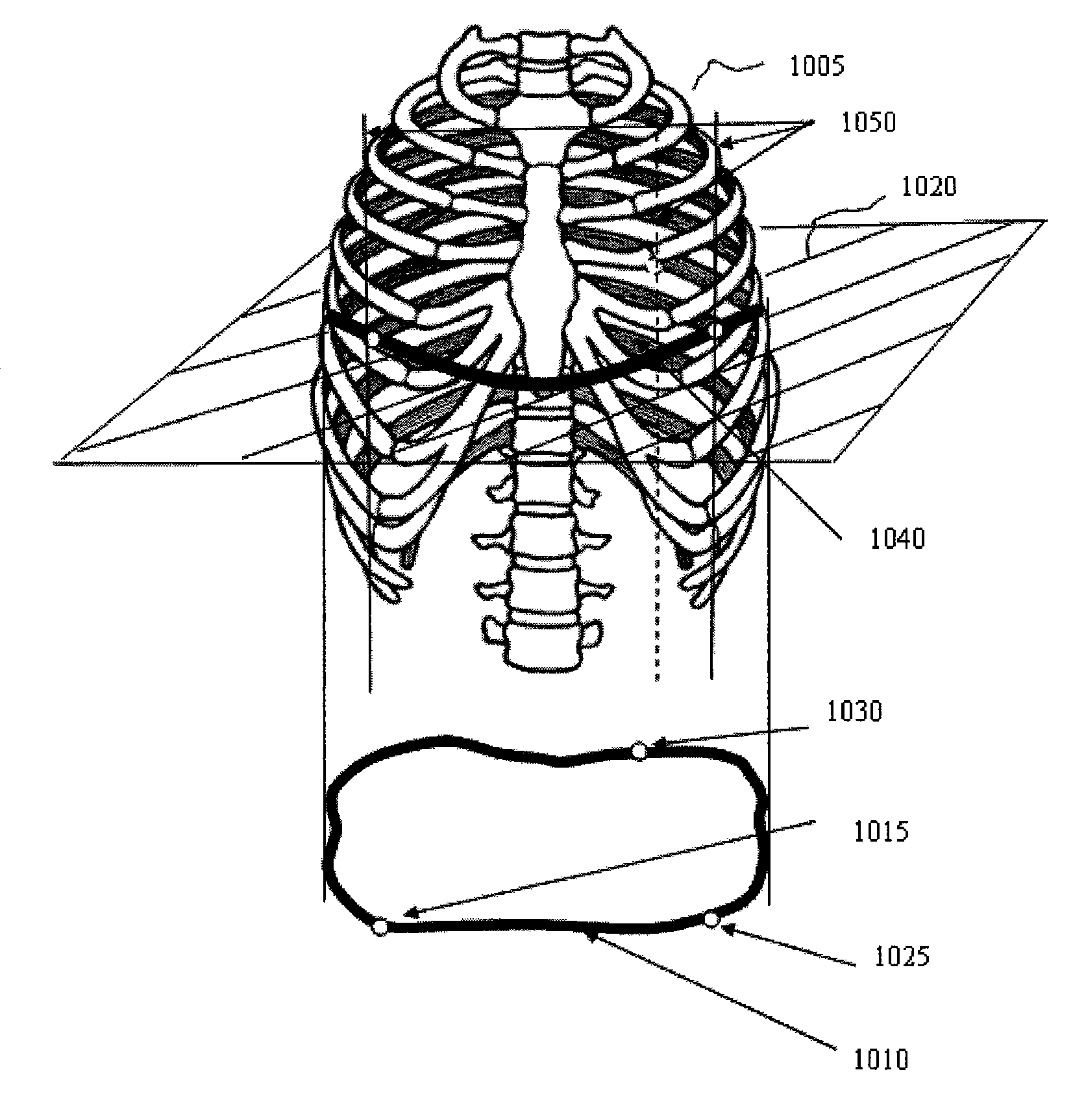 Method for generating three standard surface ECG leads derived from three electrodes contained in the mid-horizontal plane of the torso