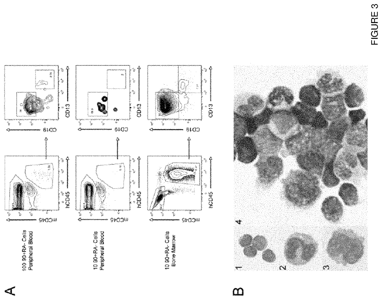 Markers of acute myeloid leukemia stem cells