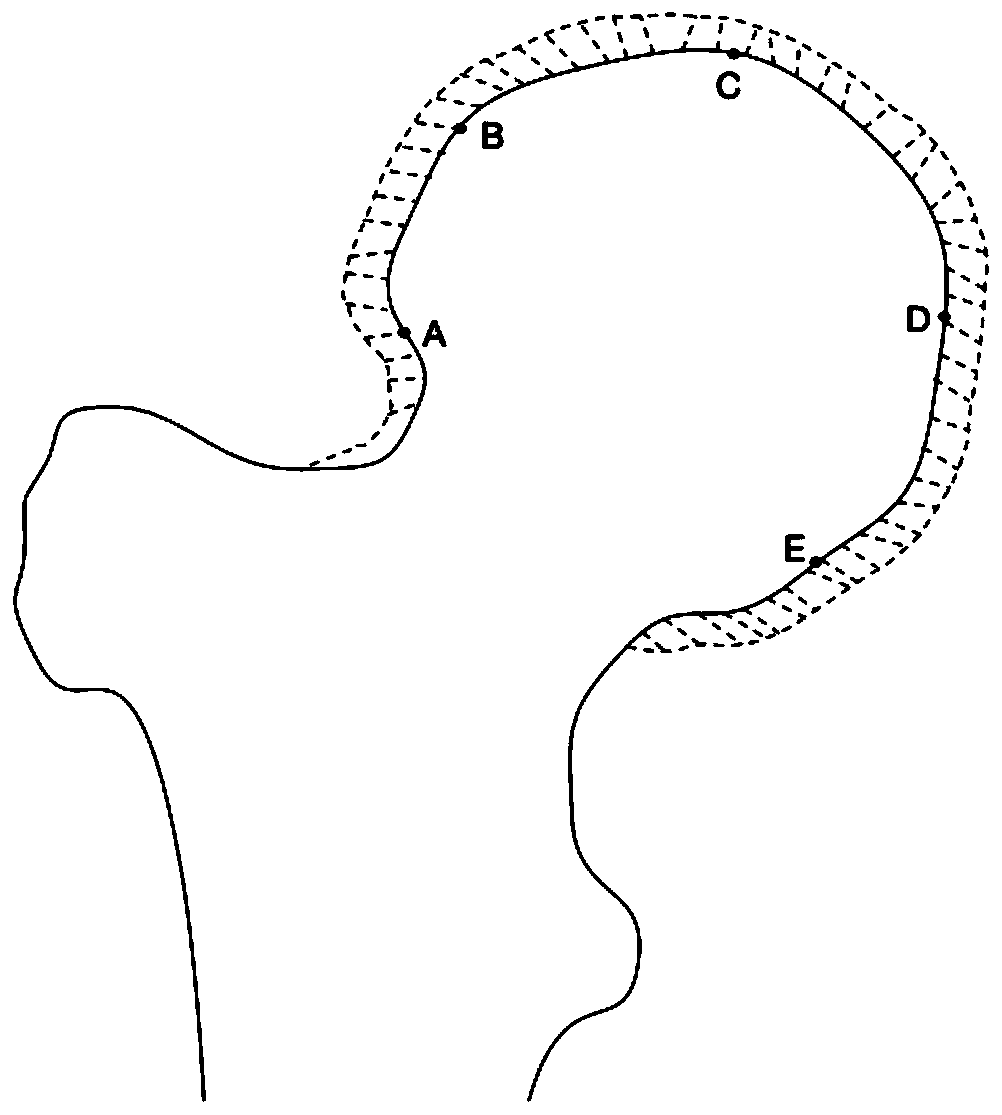 Bone surface registration method for covered cartilage